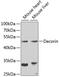 Decorin antibody, GTX55587, GeneTex, Western Blot image 