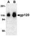 HIV gp120 antibody, orb75006, Biorbyt, Western Blot image 