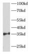 Forkhead Box R1 antibody, FNab03212, FineTest, Western Blot image 