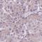 Mitotic Spindle Organizing Protein 2A antibody, HPA052623, Atlas Antibodies, Immunohistochemistry paraffin image 