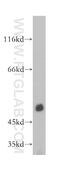 Phosphodiesterase 7B antibody, 17771-1-AP, Proteintech Group, Western Blot image 