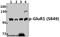 Glutamate Ionotropic Receptor AMPA Type Subunit 1 antibody, A02677S849, Boster Biological Technology, Western Blot image 