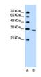 Phosphoribosyl Pyrophosphate Synthetase 2 antibody, orb330189, Biorbyt, Western Blot image 