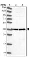 Actin Like 6B antibody, NBP1-91648, Novus Biologicals, Immunohistochemistry frozen image 