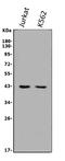 AlkB Homolog 1, Histone H2A Dioxygenase antibody, A06945-1, Boster Biological Technology, Western Blot image 