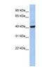 THAP Domain Containing 5 antibody, NBP1-56750, Novus Biologicals, Western Blot image 