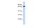 Solute Carrier Family 6 Member 1 antibody, PA5-42425, Invitrogen Antibodies, Western Blot image 