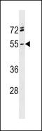 Repulsive Guidance Molecule BMP Co-Receptor A antibody, 60-366, ProSci, Western Blot image 