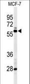 Nuclear Receptor Subfamily 1 Group H Member 3 antibody, LS-C162986, Lifespan Biosciences, Western Blot image 