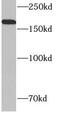 Mannose Receptor C-Type 1 antibody, FNab01442, FineTest, Western Blot image 