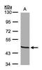 Ornithine Aminotransferase antibody, PA5-27968, Invitrogen Antibodies, Western Blot image 