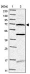 Transmembrane Protein 87B antibody, PA5-57188, Invitrogen Antibodies, Western Blot image 