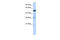 Scm Polycomb Group Protein Like 1 antibody, 25-287, ProSci, Western Blot image 