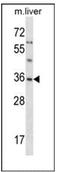 Small Glutamine Rich Tetratricopeptide Repeat Containing Alpha antibody, AP53893PU-N, Origene, Western Blot image 