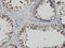 PDZ Binding Kinase antibody, LS-C133783, Lifespan Biosciences, Immunohistochemistry paraffin image 