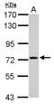 Transmembrane Protein 62 antibody, NBP2-20665, Novus Biologicals, Western Blot image 