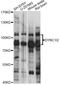 Dynein Cytoplasmic 1 Intermediate Chain 2 antibody, LS-C749707, Lifespan Biosciences, Western Blot image 
