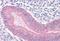Catenin Alpha 1 antibody, NB100-2917, Novus Biologicals, Immunohistochemistry paraffin image 