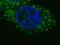 c-met antibody, abx025145, Abbexa, Western Blot image 