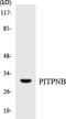 Phosphatidylinositol Transfer Protein Beta antibody, LS-C200491, Lifespan Biosciences, Western Blot image 
