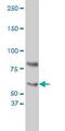 Cryptochrome Circadian Regulator 1 antibody, ab54649, Abcam, Western Blot image 