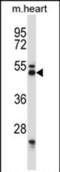 Synaptotagmin 7 antibody, PA5-71892, Invitrogen Antibodies, Western Blot image 