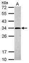 Purine Nucleoside Phosphorylase antibody, PA5-30925, Invitrogen Antibodies, Western Blot image 