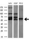 AKT Serine/Threonine Kinase 2 antibody, GTX84908, GeneTex, Western Blot image 