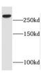 Spectrin Beta, Non-Erythrocytic 1 antibody, FNab08203, FineTest, Western Blot image 
