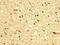 Bradykinin Receptor B2 antibody, LS-C674946, Lifespan Biosciences, Immunohistochemistry paraffin image 