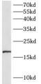 Interleukin 7 antibody, FNab10140, FineTest, Western Blot image 