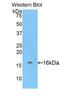 ADAM Metallopeptidase With Thrombospondin Type 1 Motif 7 antibody, LS-C292580, Lifespan Biosciences, Western Blot image 