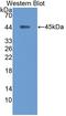 NPC Intracellular Cholesterol Transporter 2 antibody, LS-C373735, Lifespan Biosciences, Western Blot image 