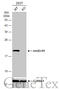 NME/NM23 Nucleoside Diphosphate Kinase 1 antibody, GTX112988, GeneTex, Western Blot image 