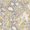 SMYD Family Member 5 antibody, LS-C334548, Lifespan Biosciences, Immunohistochemistry paraffin image 