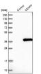 Centromere protein P antibody, NBP1-85688, Novus Biologicals, Western Blot image 