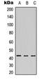 Meis Homeobox 1 antibody, LS-C368422, Lifespan Biosciences, Western Blot image 