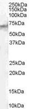 Signal transducing adapter molecule 2 antibody, PA5-18500, Invitrogen Antibodies, Western Blot image 