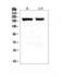 Myosin Heavy Chain 7 antibody, LS-C312448, Lifespan Biosciences, Western Blot image 