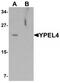 Yippee Like 4 antibody, TA320144, Origene, Western Blot image 