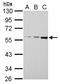 Methylcrotonoyl-CoA Carboxylase 2 antibody, NBP2-17237, Novus Biologicals, Western Blot image 