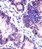 KH RNA Binding Domain Containing, Signal Transduction Associated 1 antibody, 61-145, ProSci, Immunohistochemistry frozen image 