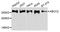 ATP Binding Cassette Subfamily C Member 2 antibody, A8405, ABclonal Technology, Western Blot image 