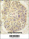 Phenylalanyl-TRNA Synthetase Subunit Alpha antibody, 62-996, ProSci, Immunohistochemistry paraffin image 