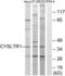 Cysteinyl Leukotriene Receptor 1 antibody, LS-B9267, Lifespan Biosciences, Western Blot image 