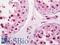 RAD51 Paralog D antibody, LS-B11381, Lifespan Biosciences, Immunohistochemistry frozen image 
