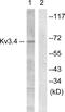 Potassium Voltage-Gated Channel Subfamily C Member 4 antibody, PA5-38658, Invitrogen Antibodies, Western Blot image 