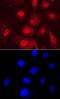 PDZ Domain Containing 2 antibody, MAB7670, R&D Systems, Immunohistochemistry paraffin image 
