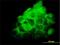 Fibronectin Type III Domain Containing 3A antibody, H00022862-M01, Novus Biologicals, Immunocytochemistry image 