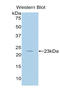 Interleukin 17 Receptor B antibody, LS-C294855, Lifespan Biosciences, Western Blot image 